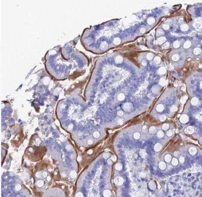 Immunohistochemistry-Paraffin: ENPP-3/CD203c Antibody [NBP1-88928]