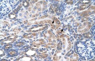 Immunohistochemistry: ENT2 Antibody [NBP1-69312]
