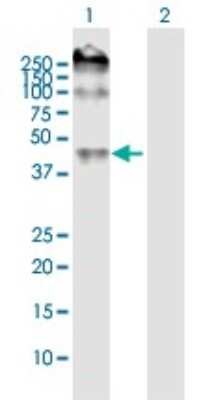 Western Blot: ENT2 Antibody [H00003177-B02P]