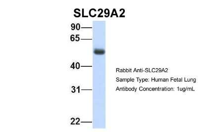 Western Blot: ENT2 Antibody [NBP1-69313]