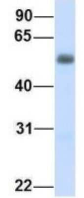 Western Blot: ENT2 Antibody [NBP1-69313]