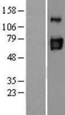 Western Blot: CD39L3/ENTPD3 Overexpression Lysate [NBL1-10282]
