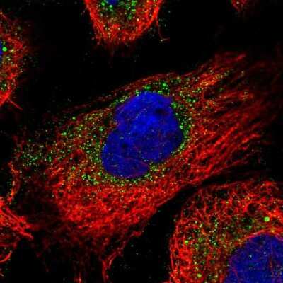 Immunocytochemistry/ Immunofluorescence: ENTPD4 Antibody [NBP1-81510]