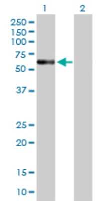 Western Blot: ENTPD4 Antibody [H00009583-B01P]