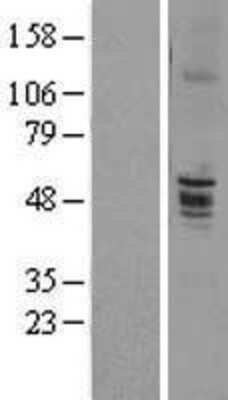 Western Blot: CD39L2/ENTPD6 Overexpression Lysate [NBL1-10283]