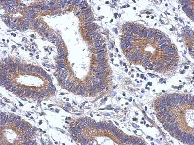 Immunohistochemistry-Paraffin: ENTPD7 Antibody [NBP2-16343]