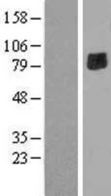 Western Blot: ENTPD7 Overexpression Lysate [NBP2-06660]