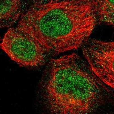 Immunocytochemistry/ Immunofluorescence: ENTPD8 Antibody [NBP1-82517]