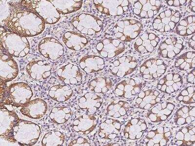 Immunohistochemistry-Paraffin: ENY2 Antibody [NBP3-06133]