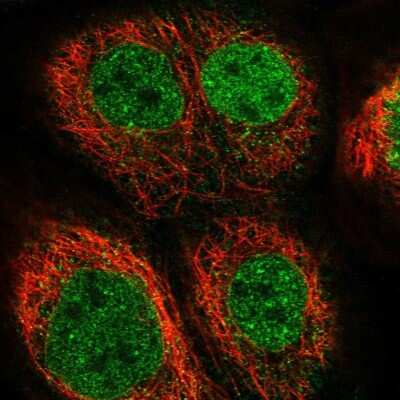 Immunocytochemistry/ Immunofluorescence: EOGT/AER61 Antibody [NBP1-90224]