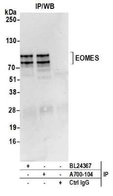 Western Blot: EOMES Antibody (BLR104H) [NBP3-07014]