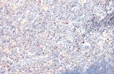 Immunohistochemistry-Paraffin: EOMES Antibody [NBP3-13136]