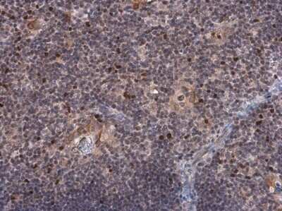 Immunohistochemistry-Paraffin: EOMES Antibody [NBP3-13356]