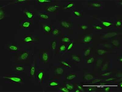 Immunocytochemistry/ Immunofluorescence: EPB41L1 Antibody [H00002036-D01P]