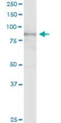 Western Blot: EPB41L1 Antibody [H00002036-D01P]