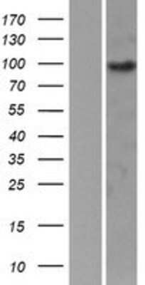 Western Blot: EPB41L1 Overexpression Lysate [NBP2-09845]