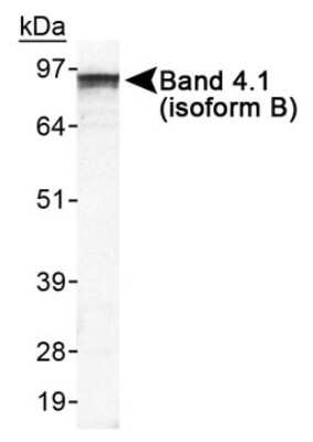Western Blot: EPB41L3 AntibodyBSA Free [NB110-61027]