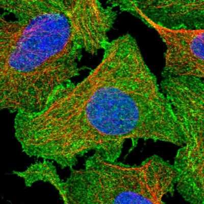 Immunocytochemistry/ Immunofluorescence: EPB41L5 Antibody [NBP2-38354]