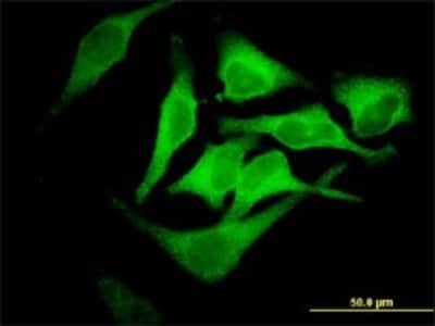 Immunocytochemistry/ Immunofluorescence: EPB42 Antibody (2G12) [H00002038-M01]