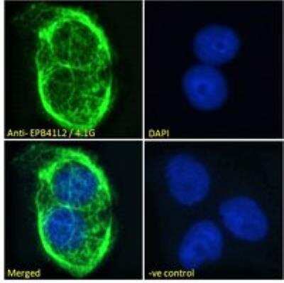Immunocytochemistry/ Immunofluorescence: EPB4IL2 Antibody [NBP1-06034]