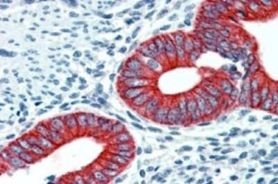Immunohistochemistry-Paraffin: EPB4IL2 Antibody [NBP1-06034]