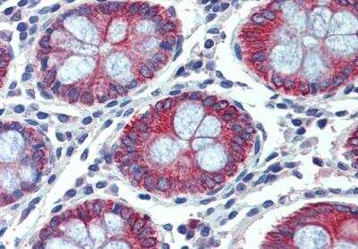 Immunohistochemistry-Paraffin: EPB4IL2 Antibody [NBP1-06034]