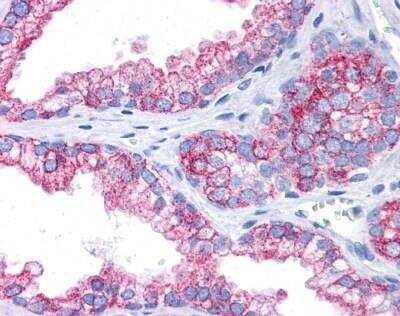 Immunohistochemistry-Paraffin: EPB4IL2 Antibody [NBP1-56763]