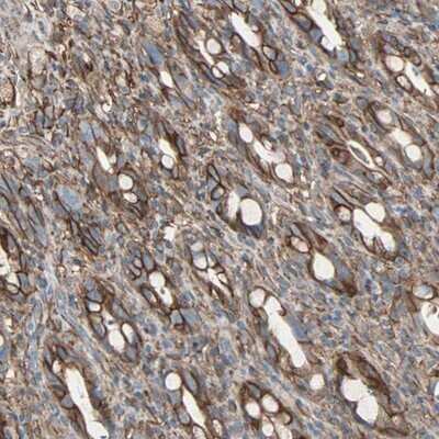 Immunohistochemistry-Paraffin: EPB4IL2 Antibody [NBP1-90325]