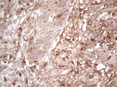 Immunohistochemistry: EPCR Antibody (OTI12H5) [NBP2-45395]