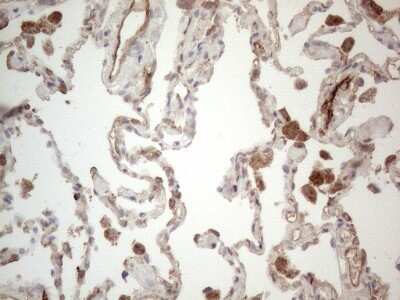 Immunohistochemistry: EPCR Antibody (OTI12H5) [NBP2-45395]