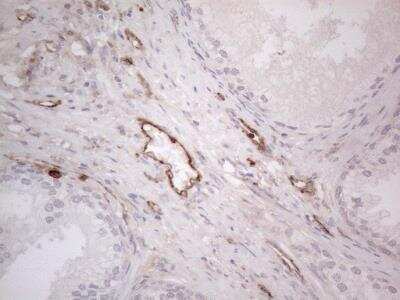 Immunohistochemistry-Paraffin: EPCR Antibody (OTI12H5) [NBP2-45395]