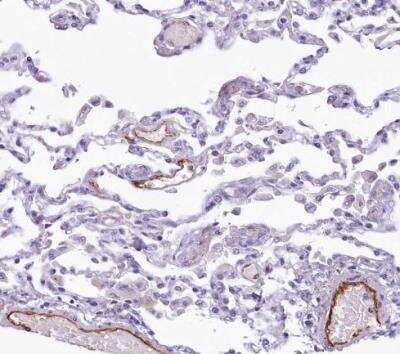 Immunohistochemistry-Paraffin: EPCR Antibody [NBP1-88168]