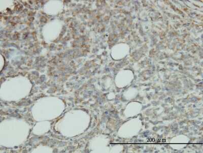 Immunohistochemistry-Paraffin: EPCR Antibody (M2) [H00010544-M03]