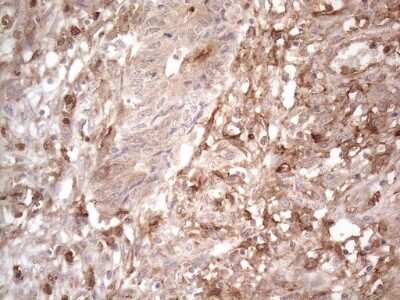 Immunohistochemistry: EPCR Antibody (OTI12H5) - Azide and BSA Free [NBP2-71607]