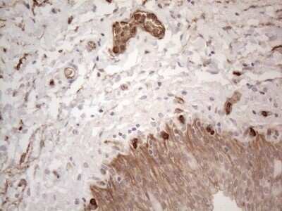 Immunohistochemistry: EPCR Antibody (OTI12H5) - Azide and BSA Free [NBP2-71607]
