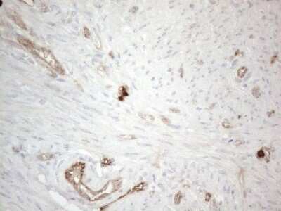 Immunohistochemistry: EPCR Antibody (OTI12H5) - Azide and BSA Free [NBP2-71607]