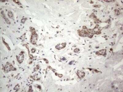 Immunohistochemistry: EPCR Antibody (OTI12H5) - Azide and BSA Free [NBP2-71607]