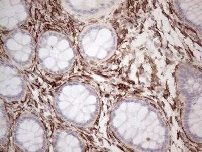 Immunohistochemistry: EPCR Antibody (OTI12H5) - Azide and BSA Free [NBP2-71607]