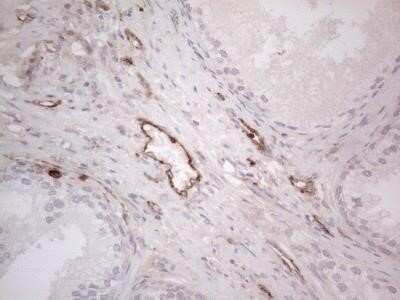 Immunohistochemistry: EPCR Antibody (OTI12H5) - Azide and BSA Free [NBP2-71607]