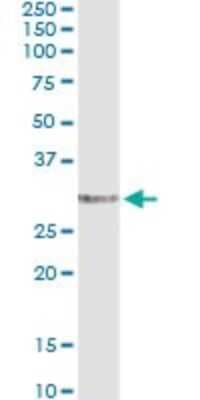 Immunoprecipitation: EPDR1 Antibody (1C1) [H00054749-M01]