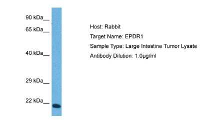 Western Blot: EPDR1 Antibody [NBP2-88811]