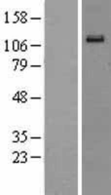 Western Blot: EphA6 Overexpression Lysate [NBL1-10291]