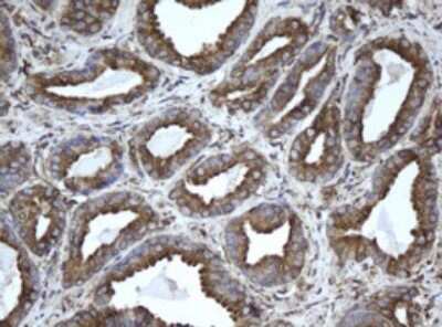 Immunohistochemistry: EPHX1 Antibody (OTI3F10) [NBP2-45478]