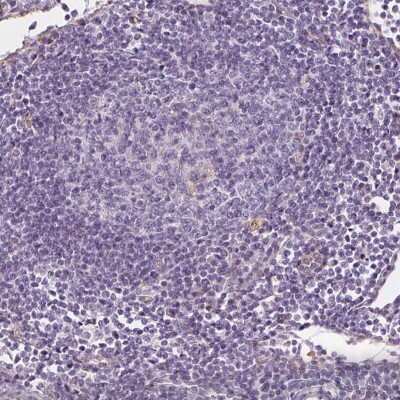Immunohistochemistry-Paraffin: EPHX1 Antibody [NBP1-83969]
