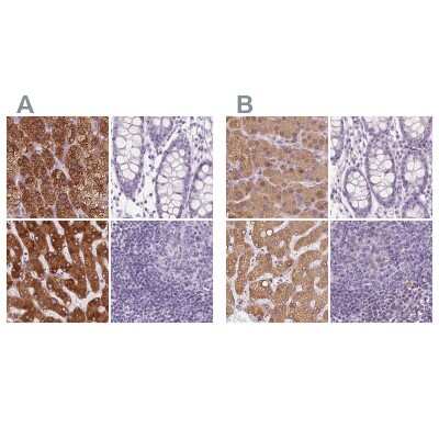 Immunohistochemistry-Paraffin: EPHX1 Antibody [NBP2-38594]