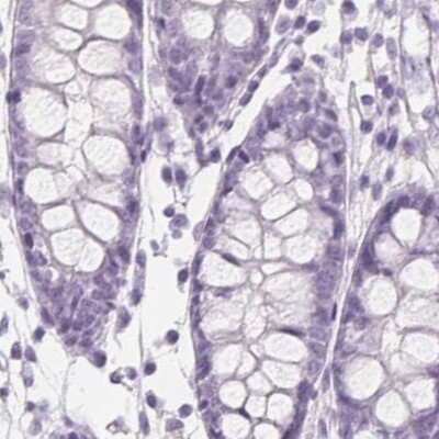 Immunohistochemistry-Paraffin: EPHX1 Antibody [NBP2-38594]