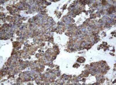 Immunohistochemistry: EPHX1 Antibody (OTI3F10) - Azide and BSA Free [NBP2-70646]