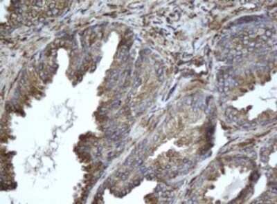 Immunohistochemistry: EPHX1 Antibody (OTI3F10) - Azide and BSA Free [NBP2-70646]