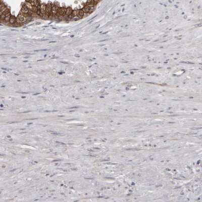 Immunohistochemistry-Paraffin: EPHX2 Antibody [NBP1-89534]