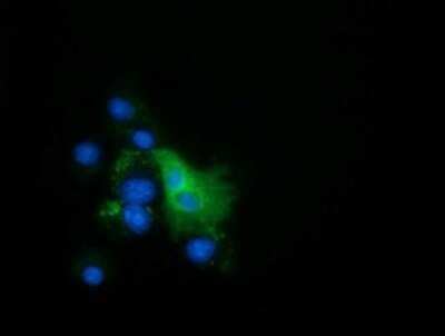 Immunocytochemistry/ Immunofluorescence: EPHX2 Antibody (OTI1A6) - Azide and BSA Free [NBP2-70648]